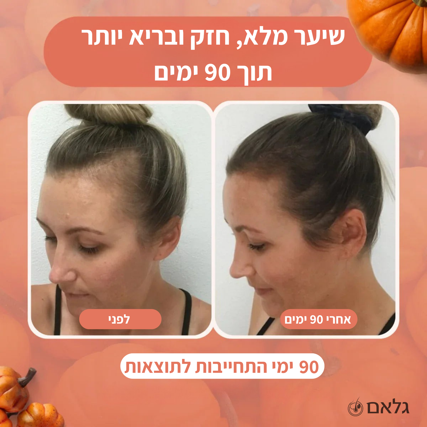 שמן זרעי דלעת - קפסולות רכות